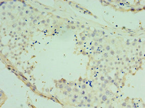 SPAG16 Antibody in Immunohistochemistry (Paraffin) (IHC (P))