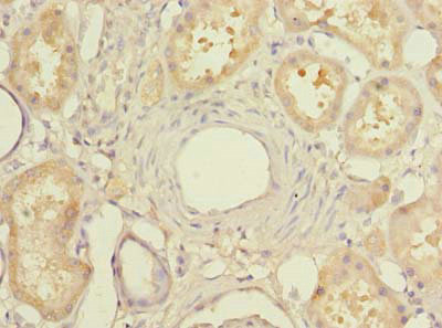 MIER2 Antibody in Immunohistochemistry (Paraffin) (IHC (P))