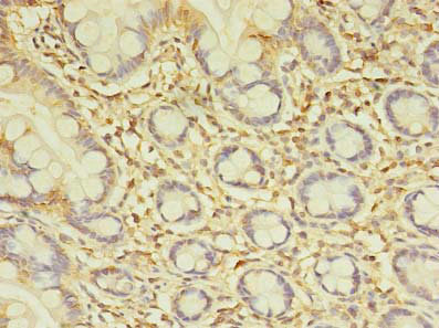 SPIC Antibody in Immunohistochemistry (Paraffin) (IHC (P))