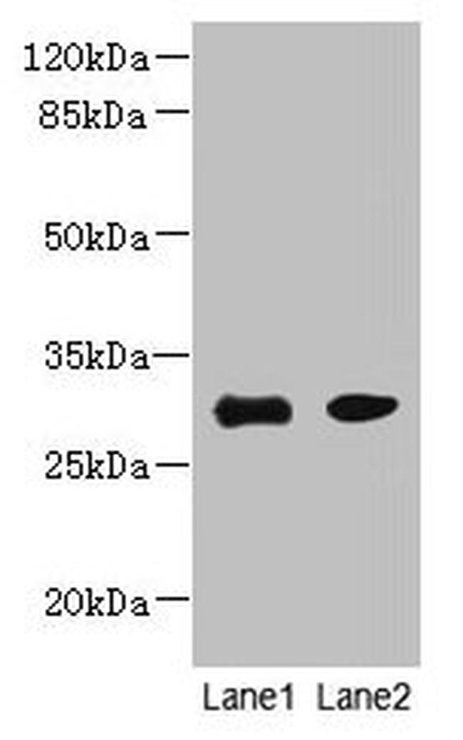 PI4KAP1 Antibody in Western Blot (WB)