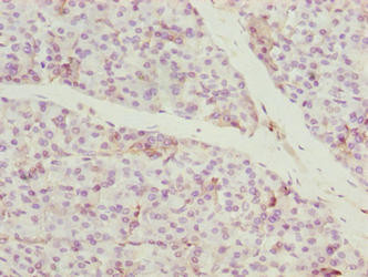 CCDC89 Antibody in Immunohistochemistry (Paraffin) (IHC (P))
