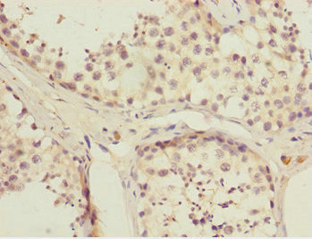 FAM48A Antibody in Immunohistochemistry (Paraffin) (IHC (P))