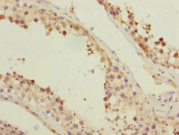 FAM48A Antibody in Immunohistochemistry (Paraffin) (IHC (P))