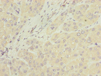 NUBPL Antibody in Immunohistochemistry (Paraffin) (IHC (P))