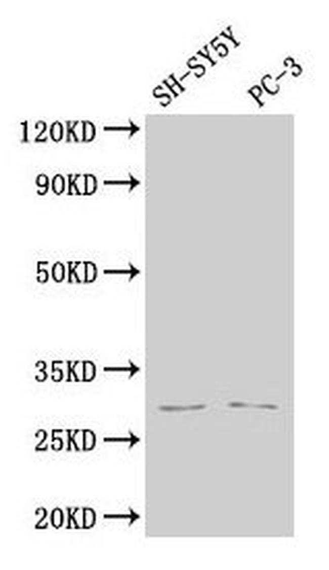 APH1B Antibody in Western Blot (WB)