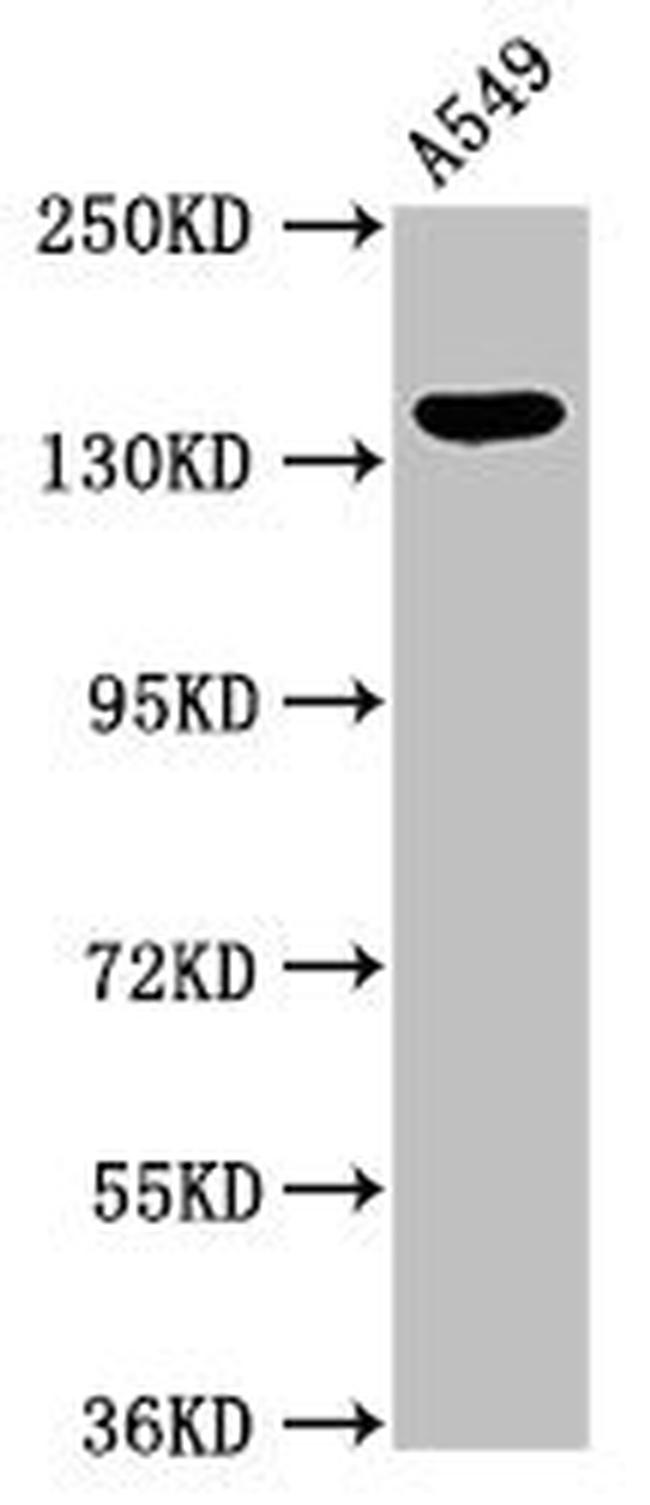 PLIN4 Antibody in Western Blot (WB)