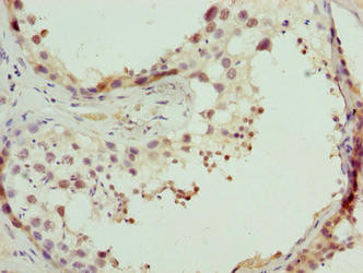 CPXCR1 Antibody in Immunohistochemistry (Paraffin) (IHC (P))