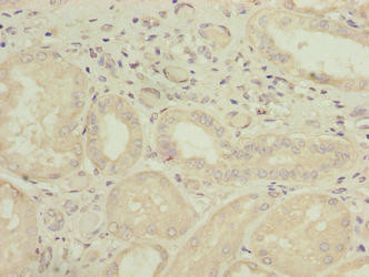 GALNT15 Antibody in Immunohistochemistry (Paraffin) (IHC (P))