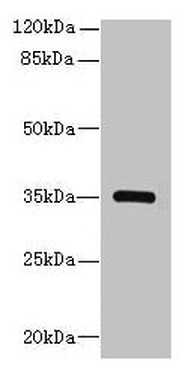 STX19 Antibody in Western Blot (WB)