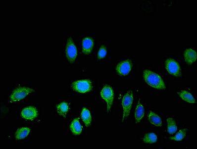 ATP6V1C2 Antibody in Immunocytochemistry (ICC/IF)