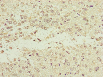 NEDD1 Antibody in Immunohistochemistry (Paraffin) (IHC (P))