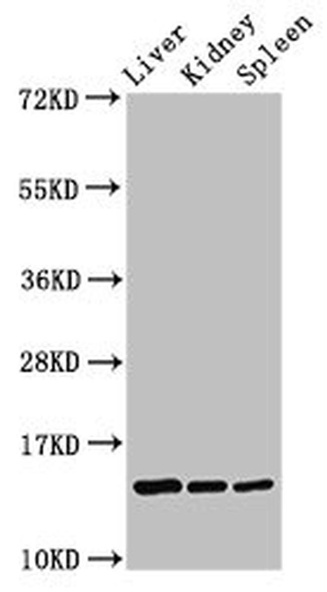 CCDC26 Antibody in Western Blot (WB)