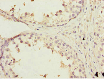 KBTBD7 Antibody in Immunohistochemistry (Paraffin) (IHC (P))
