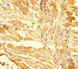 RGMA Antibody in Immunohistochemistry (Paraffin) (IHC (P))