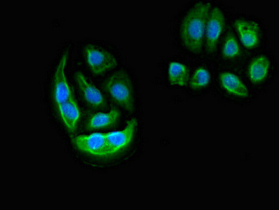 ELMO2 Antibody in Immunocytochemistry (ICC/IF)