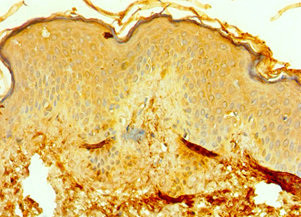 RMDN3 Antibody in Immunohistochemistry (Paraffin) (IHC (P))