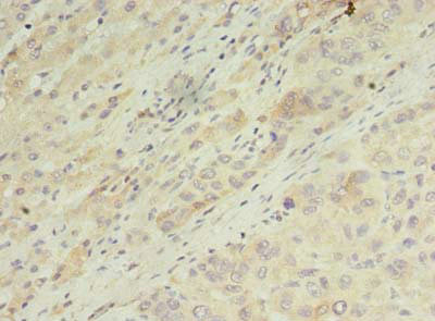 ARF7 Antibody in Immunohistochemistry (Paraffin) (IHC (P))