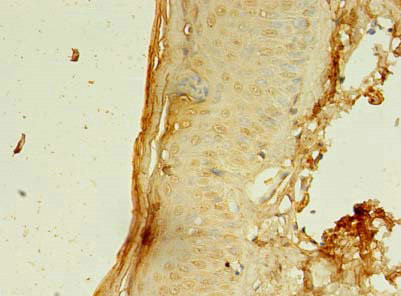 CCDC24 Antibody in Immunohistochemistry (Paraffin) (IHC (P))