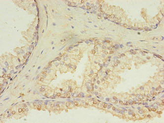 HDDC3 Antibody in Immunohistochemistry (Paraffin) (IHC (P))