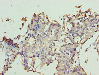 TTC9C Antibody in Immunohistochemistry (Paraffin) (IHC (P))