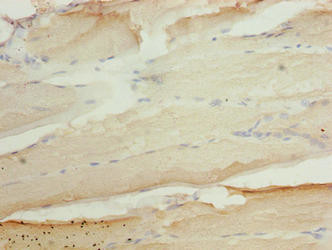 ASAP3 Antibody in Immunohistochemistry (Paraffin) (IHC (P))
