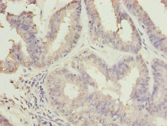 C10orf82 Antibody in Immunohistochemistry (Paraffin) (IHC (P))