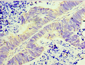 GLYATL1 Antibody in Immunohistochemistry (Paraffin) (IHC (P))