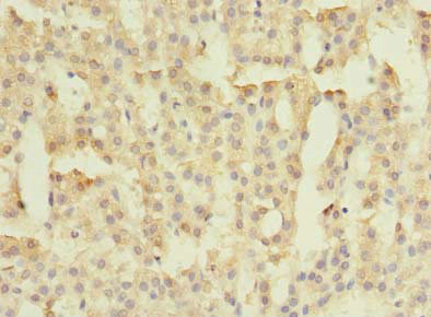 FAM149B1 Antibody in Immunohistochemistry (Paraffin) (IHC (P))