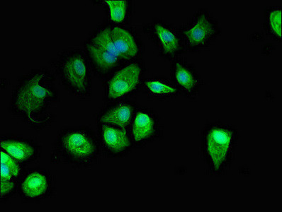C22orf13 Antibody in Immunocytochemistry (ICC/IF)