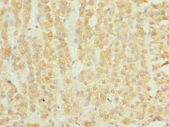 ELMOD1 Antibody in Immunohistochemistry (Paraffin) (IHC (P))