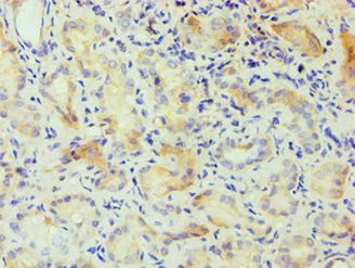 CSNK1A1L Antibody in Immunohistochemistry (Paraffin) (IHC (P))