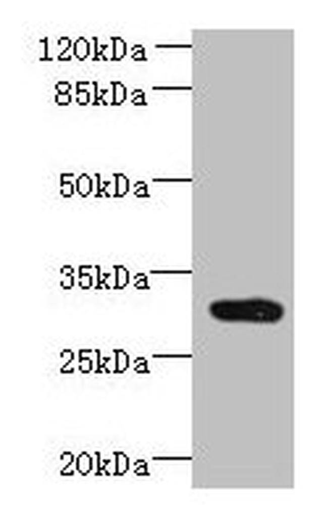 CCDC127 Antibody in Western Blot (WB)