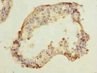 CCDC42 Antibody in Immunohistochemistry (Paraffin) (IHC (P))