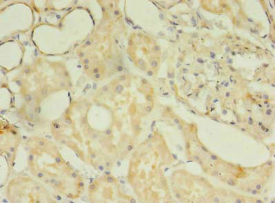 TSGA13 Antibody in Immunohistochemistry (Paraffin) (IHC (P))
