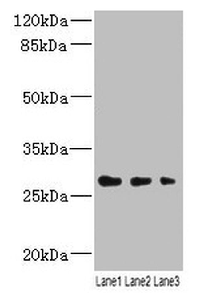 LRRC57 Antibody in Western Blot (WB)