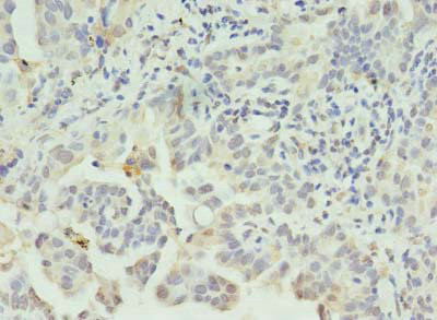 CLEC1A Antibody in Immunohistochemistry (Paraffin) (IHC (P))