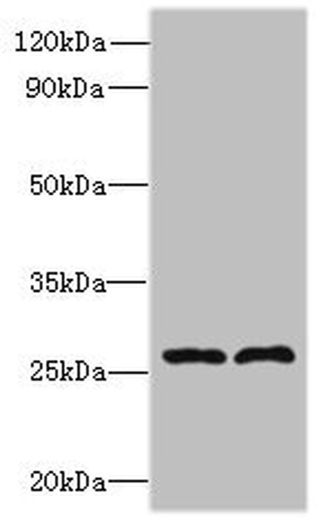 FAM71C Antibody in Western Blot (WB)