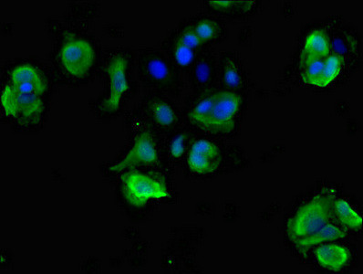 STOML3 Antibody in Immunocytochemistry (ICC/IF)