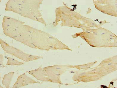 FBXO30 Antibody in Immunohistochemistry (Paraffin) (IHC (P))