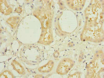 L3HYPDH Antibody in Immunohistochemistry (Paraffin) (IHC (P))