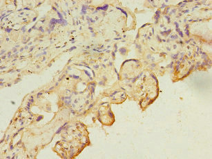 CA13 Antibody in Immunohistochemistry (Paraffin) (IHC (P))