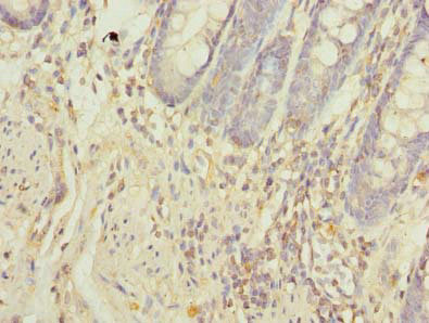 FAM55A Antibody in Immunohistochemistry (Paraffin) (IHC (P))