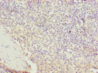 STPG2 Antibody in Immunohistochemistry (Paraffin) (IHC (P))