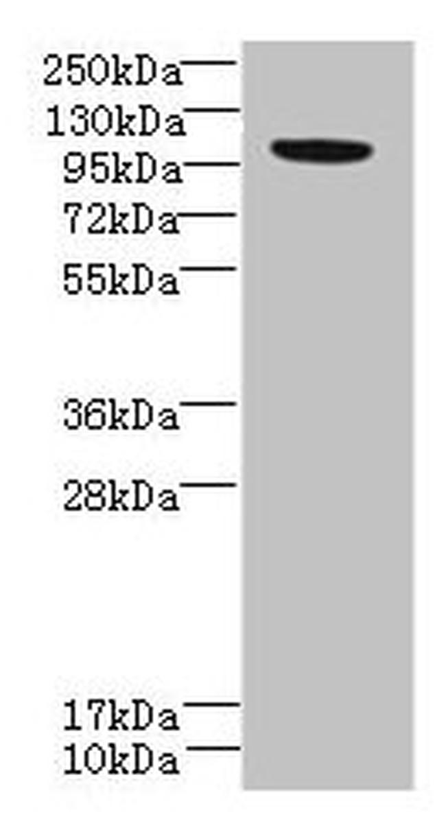 PPFIBP2 Antibody in Western Blot (WB)