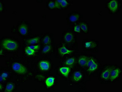 FA156 Antibody in Immunocytochemistry (ICC/IF)