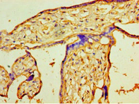 PIGX Antibody in Immunohistochemistry (Paraffin) (IHC (P))
