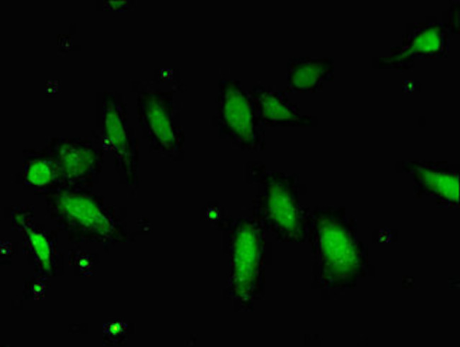 FBXO25 Antibody in Immunocytochemistry (ICC/IF)