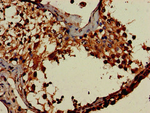 Dot1L Antibody in Immunohistochemistry (Paraffin) (IHC (P))