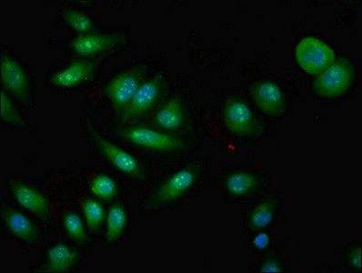 CPNE4 Antibody in Immunocytochemistry (ICC/IF)