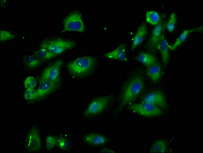 PIK3IP1 Antibody in Immunocytochemistry (ICC/IF)